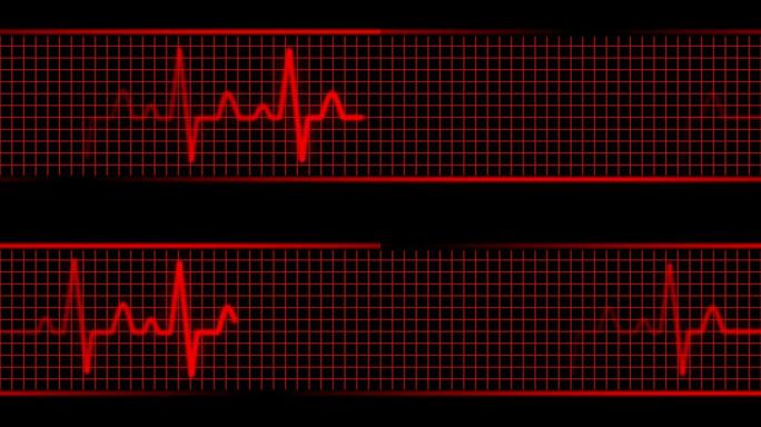 红色ekg机器无缝循环高清1080i
