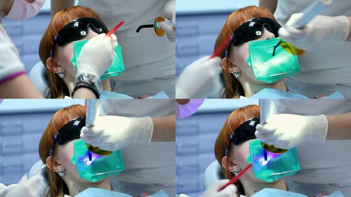 牙科手术中使用紫外线固化光干燥嵌体