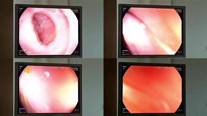 内窥镜诊断监视器