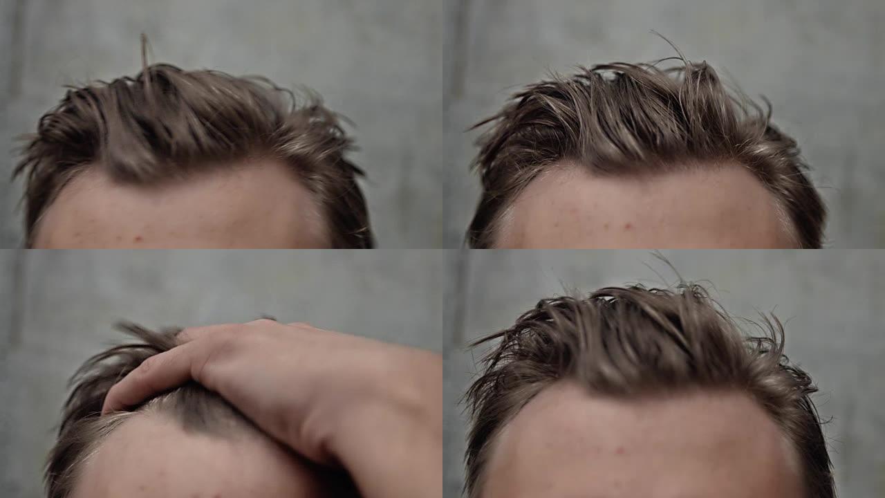 男人的头发、前额和头皮
