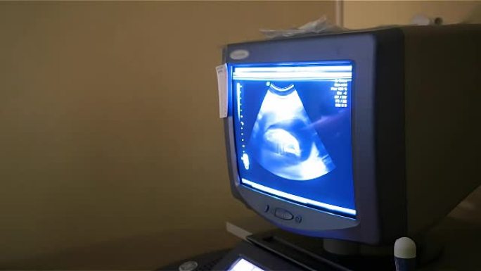 体检期间孕妇