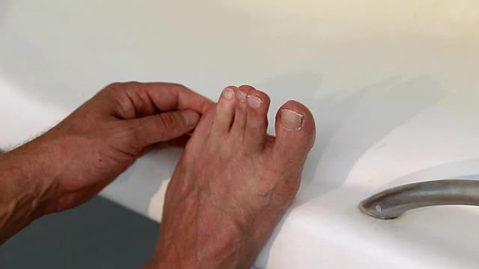 男子在浴室用剪刀剪脚趾甲。高加索人徒步修剪脚趾甲。特写。