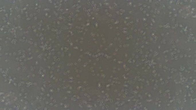 显微镜下精子