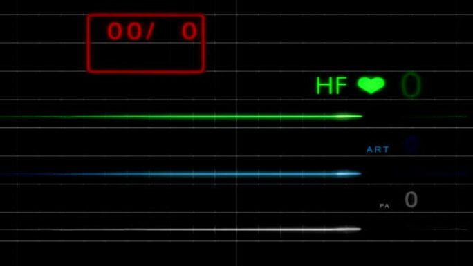E.C.G监视器-无脉冲-带网格-高清