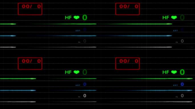 E.C.G监视器-无脉冲-带网格-高清