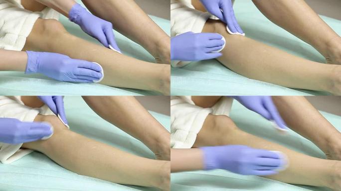 美容师在手术前用棉质海绵擦拭患者的脚。消毒