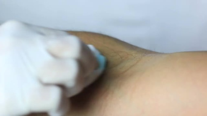高清录像，抽血，护士将针头插入献血者的手臂，在研究实验室进行血液检查