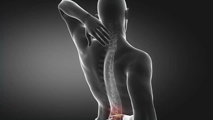 脊柱疼痛可传到颈部