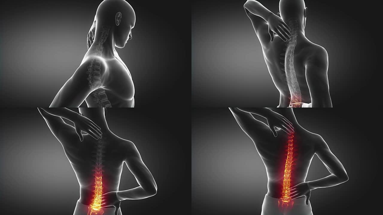 脊柱疼痛可传到颈部