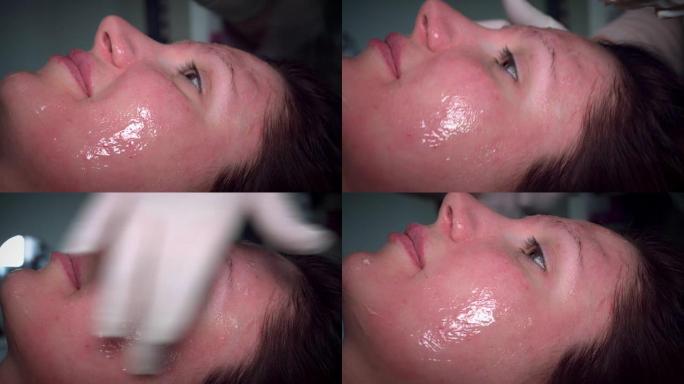 4k医生在女性脸上涂抹凝胶进行手术