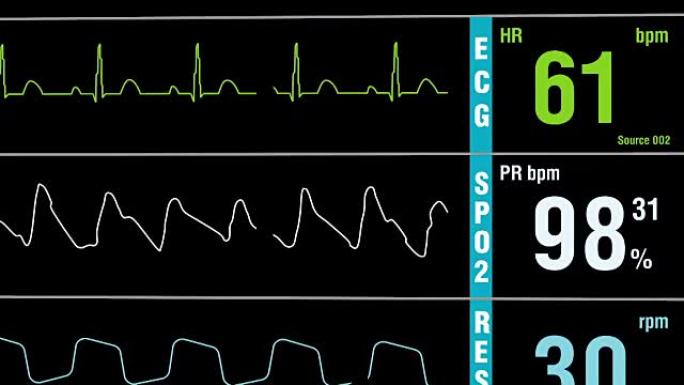 患者监护仪显示体检生命体征