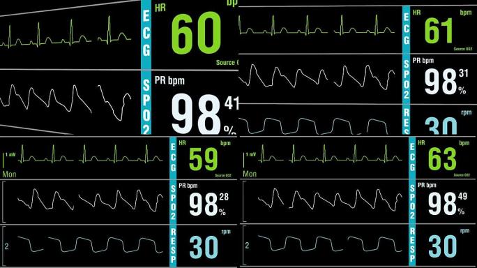 患者监护仪显示体检生命体征