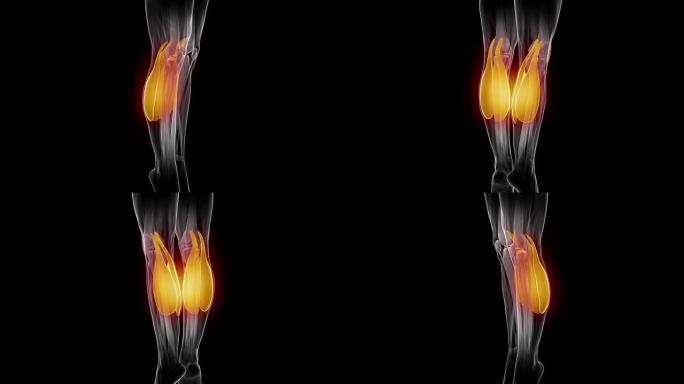 腓肠肌-可见肌肉解剖图