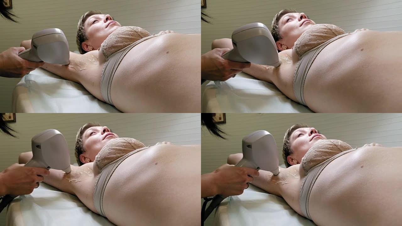 女人在腋下接受激光脱毛治疗