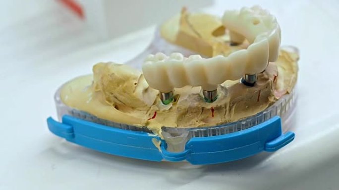 牙科技师正在工作整体氧化锆。