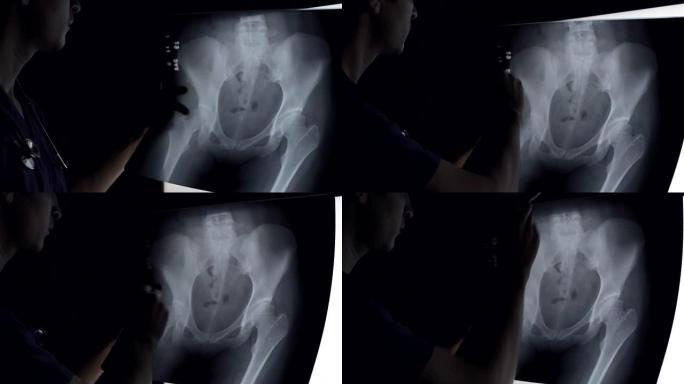 医生分析骨盆骨骼的x射线。