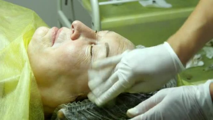 美容师的手正在为手术或手术后的清洁准备皮肤。老妇人在美容院撒谎和化妆。在睫毛上涂抹永久化妆。