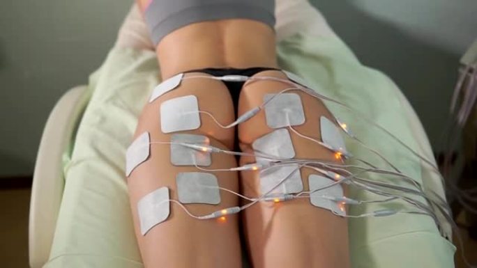电刺激疗法的女士。腿部的电生物刺激。
