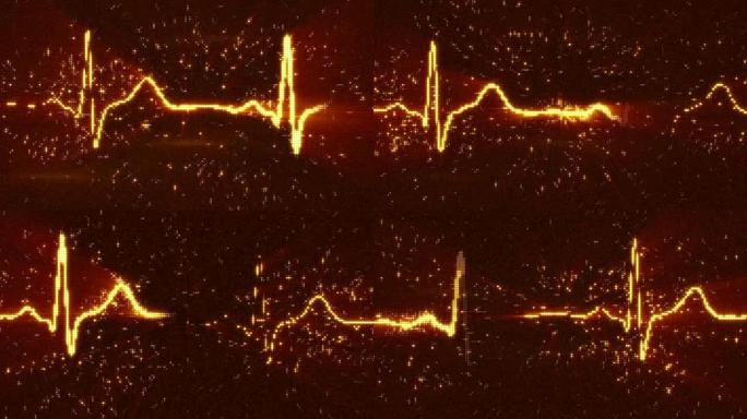 橙色EKG心电图波形可循环动画