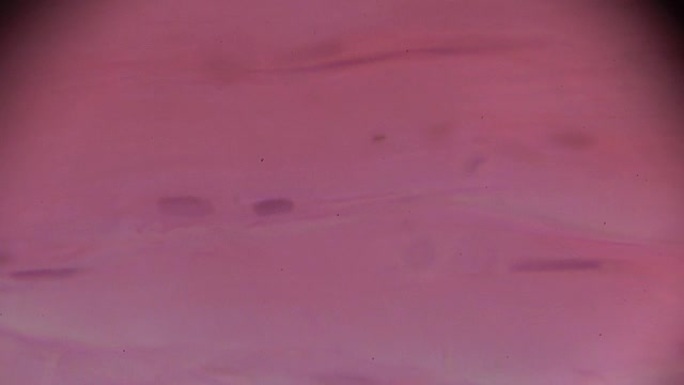 显微镜下致密结缔组织