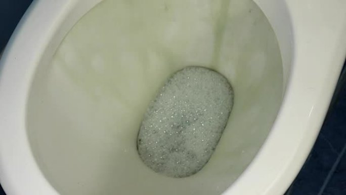 厕所里肮脏、生锈、绿色的水。