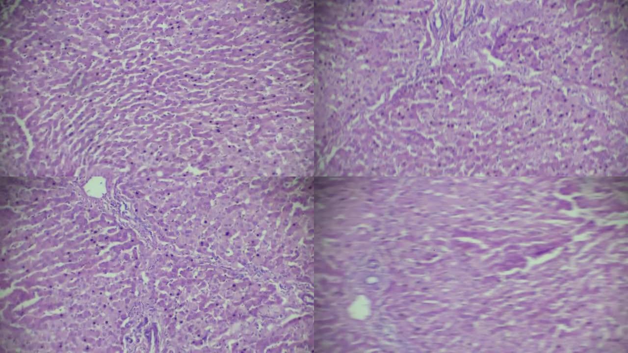 显微镜下肝细胞