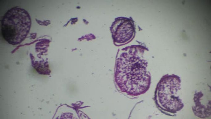 显微镜下的鱼卵巢横截面