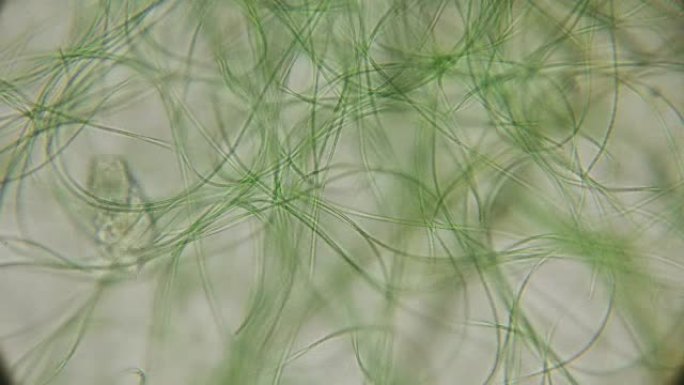活藻类在显微镜下的运动，类似于身体的触角，这非常令人兴奋