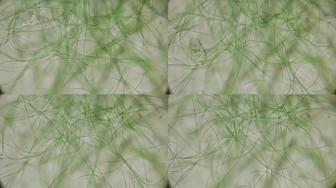 活藻类在显微镜下的运动，类似于身体的触角，这非常令人兴奋