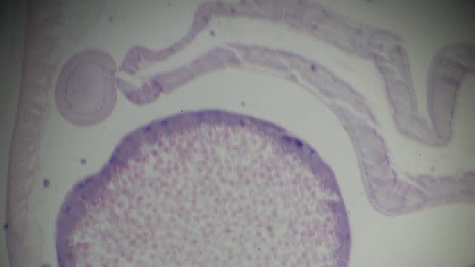 光学显微镜下的Ascaris c.s.