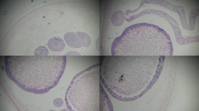 光学显微镜下的Ascaris c.s.