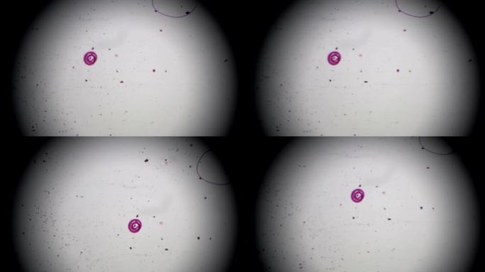光学显微镜下的旋毛虫