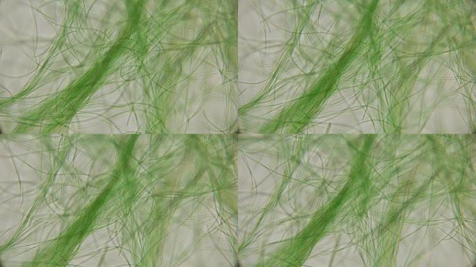 活藻类在显微镜下的运动，类似于身体的触角，这非常令人兴奋