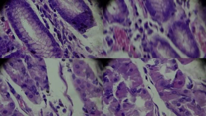 胃黏膜肠上皮化生镜下