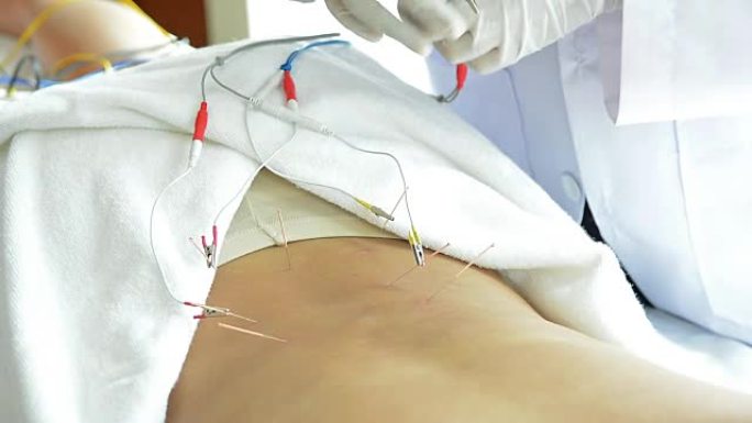由针灸师，治疗师为顾客的背部提供电针治疗的年轻美女的多莉镜头，用电机进行电针治疗