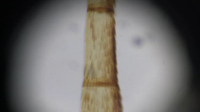 光学显微镜下的蝴蝶天线
