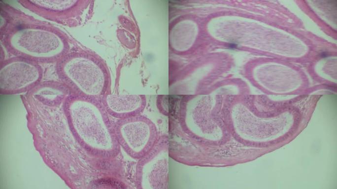 显微镜下睾丸和附睾片