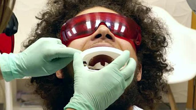 一个人在牙医那里准备牙齿美白的视频，牙医给了他一个护嘴器