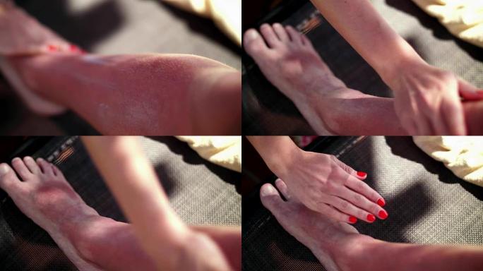 特写，女性的手摩擦，涂抹防晒霜，一种特殊的，治疗性的面霜在男人的腿上，具有强烈的晒伤，防癌概念