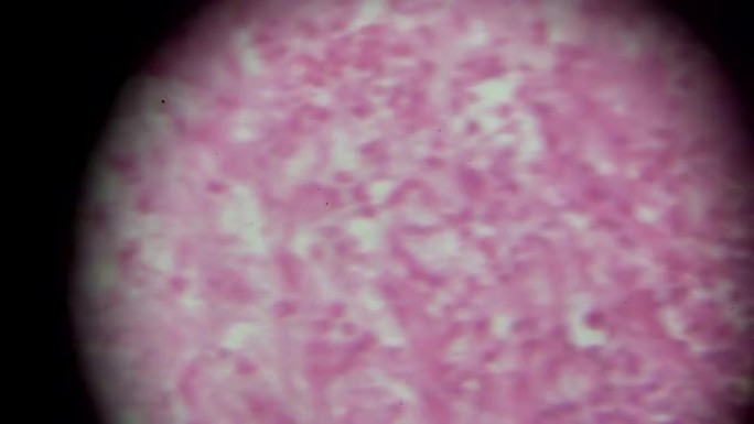 显微镜下中性粒细胞