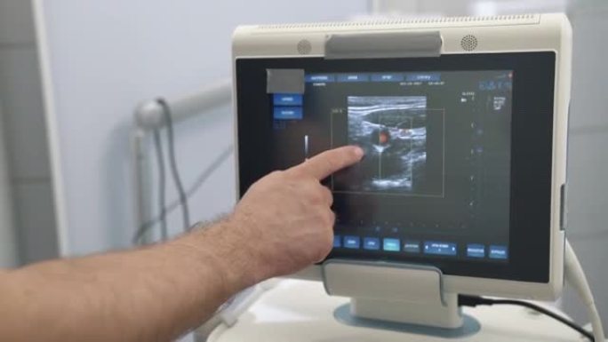 超声波检查设备监测特写，彩色人体器官。医院或诊所的医疗工具