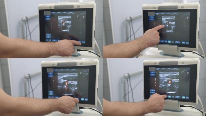 超声波检查设备监测特写，彩色人体器官。医院或诊所的医疗工具
