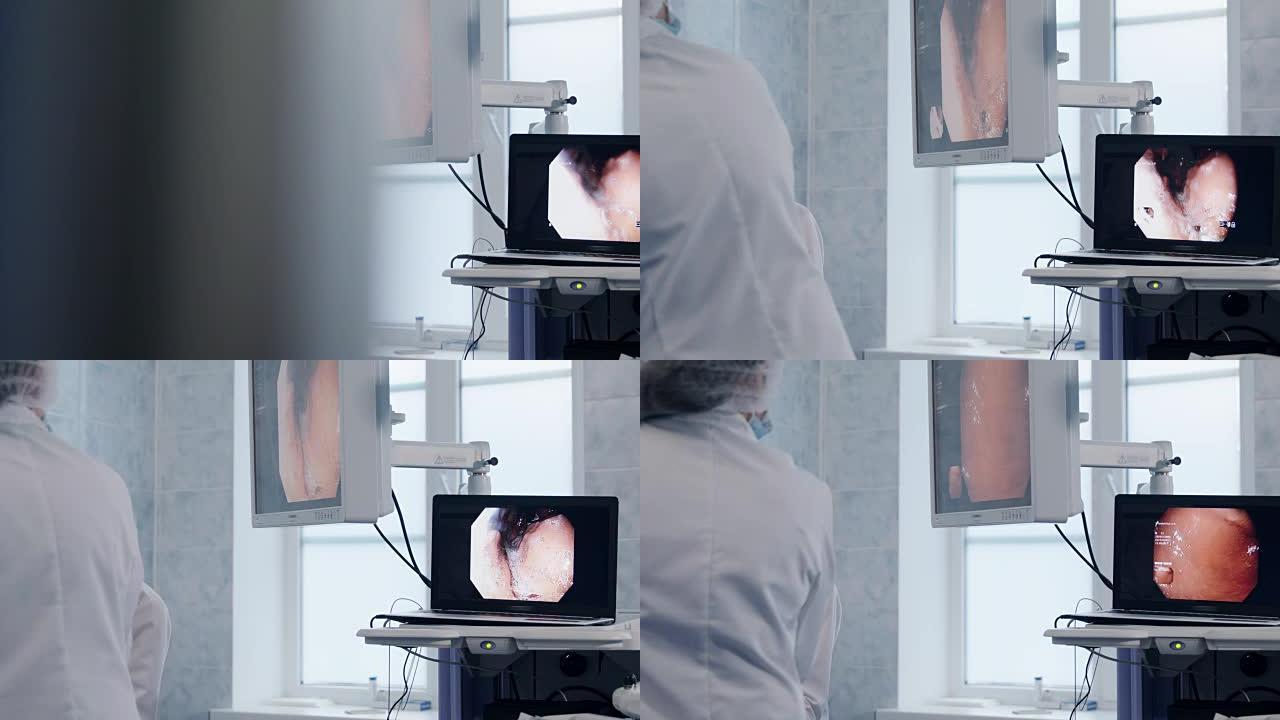屏幕上的光纤胃镜检查过程