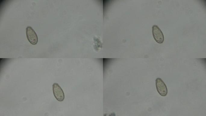 光镜下肝吸虫支睾吸虫病虫卵