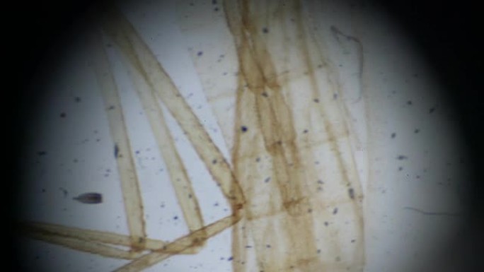 显微镜下的蚊子雌性w.M.