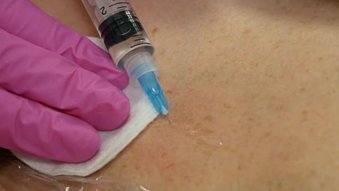 英俊的女人在脖子和胸部皮肤上注射该程序使医生戴着粉红色的手套。中间疗法的概念