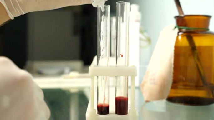 测试血样。实验室男医生的手用血液在试管中添加过氧化氢。关闭慢动作侧视图