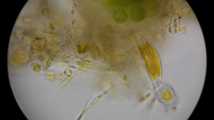 显微镜下的硅藻和微生物