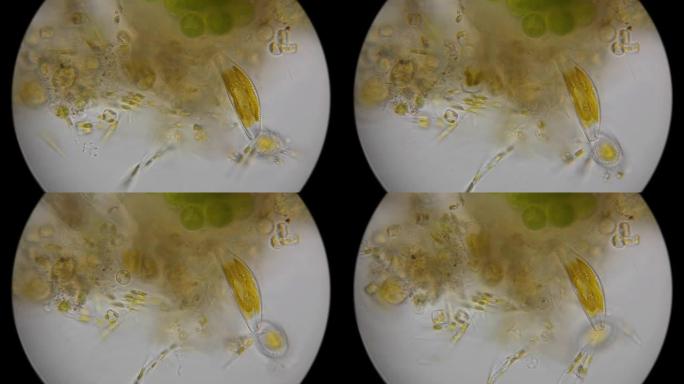 显微镜下的硅藻和微生物