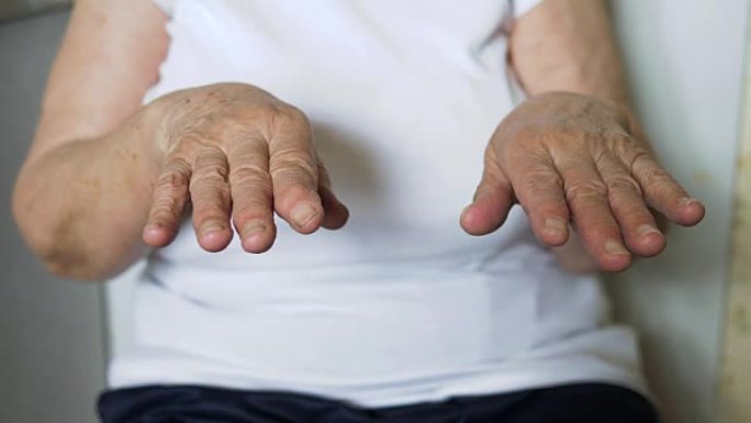帕金森氏症和老妇人的手颤